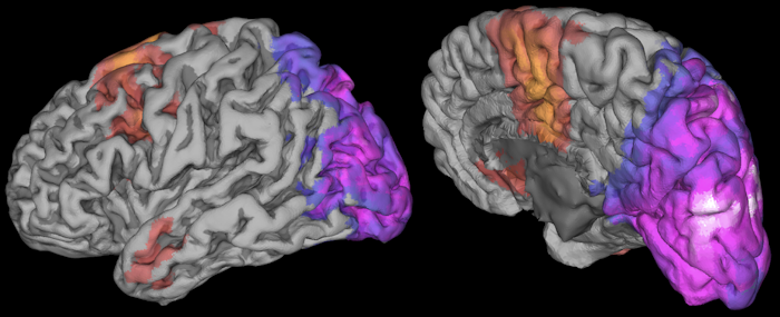 3D brains with functional map